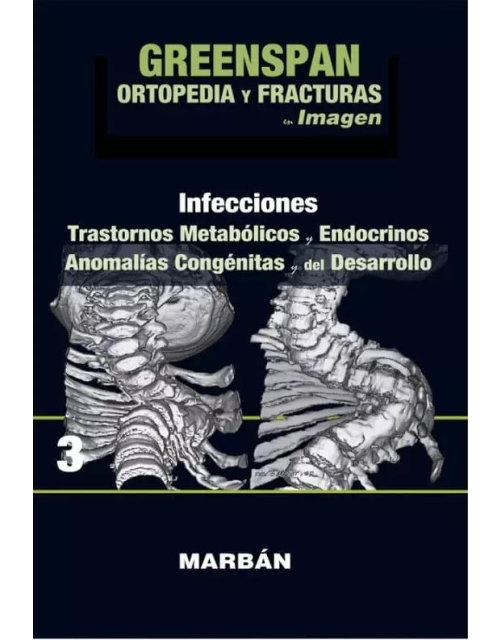 Ortopedia Y Fracturas Img, Tomo 3, Infecciones
