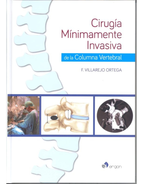 Cirugía Mínimamente Invasiva De La Columna Vertebral