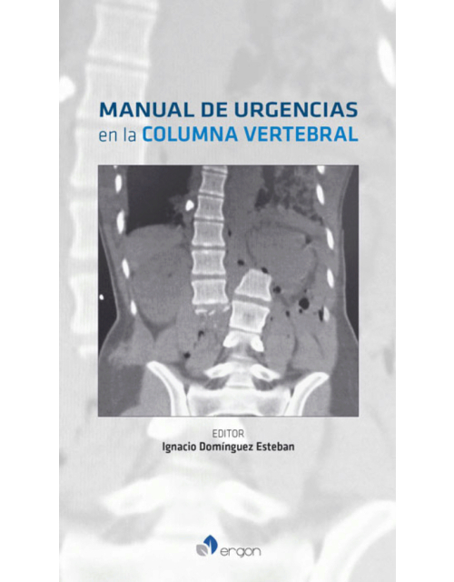 Manual De Urgencias En La Columna Vertebral