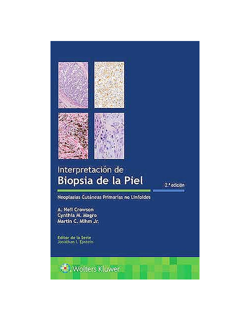 Interpretación De Biopsias De La Piel .