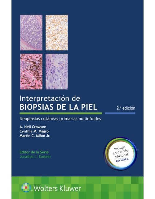 Interpretación De Biopsias De La Piel .