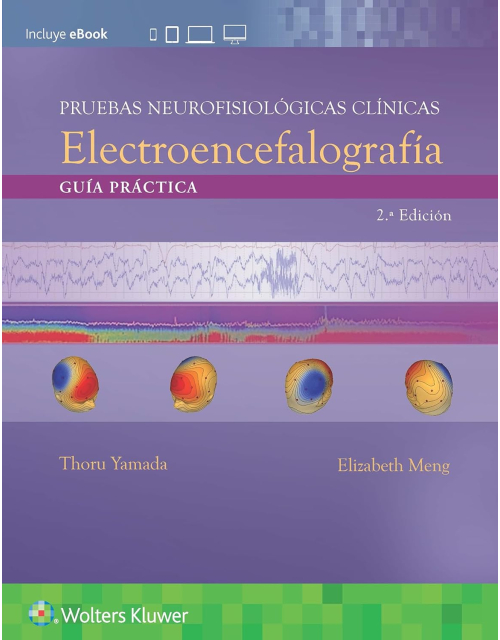 Pruebas Neurofisiológicas Clínicas. Electroencefalografía .