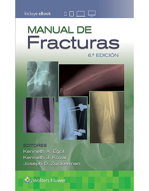 Manual De Fracturas