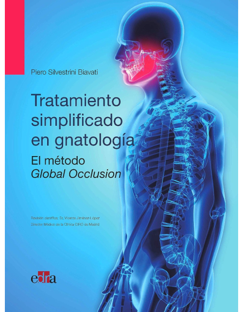 Oclusión Global Tratamiento Simplificado En Gnatología