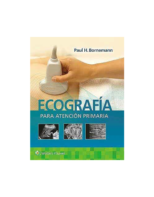 Ecografía Para Atención Primaria
