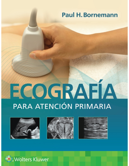 Ecografía Para Atención Primaria