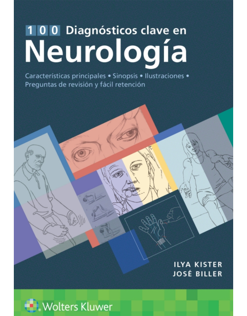 100 Diagnósticos Clave en Neurología