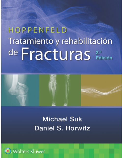 Hoppenfeld Tratamiento Y Rehabilitación De Fracturas.