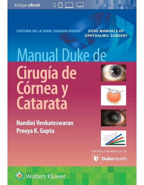Manual Duke De Cirugía De Córnea Y Catarata.