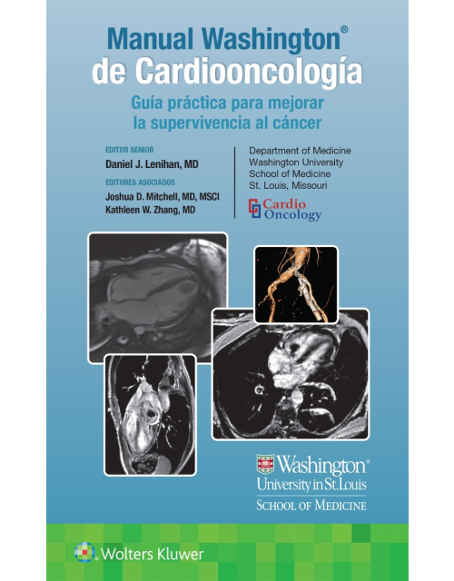 Manual WASHINGTON® de Cardiooncología