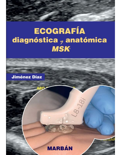 Ecografía Diagnóstica y Anatómica MSK