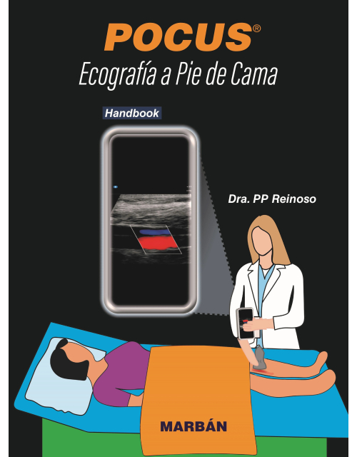 POCUS. Ecografía a Pie de Cama. Handbook