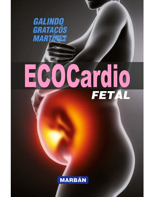 Ecocardio Fetal