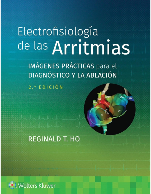 Electrofisiología de las Arritmias