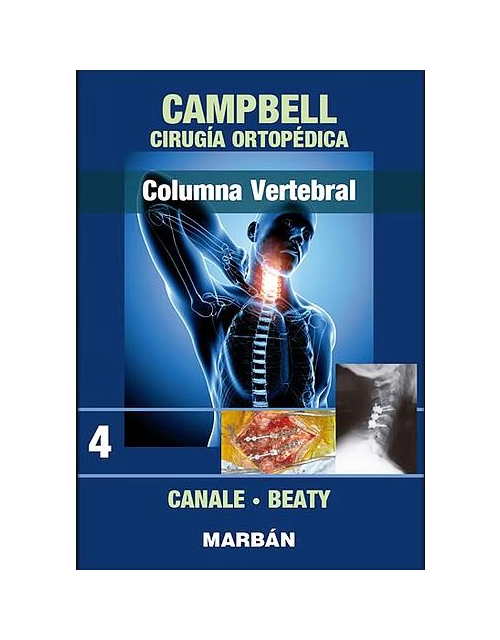 Campbell Cirugía Ortopédica, Tomo 4: Columna Vertebral