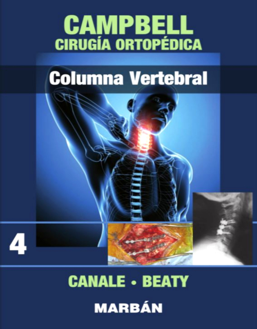 Campbell Cirugía Ortopédica, Tomo 4: Columna Vertebral