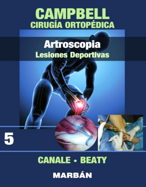 CAMPBELL Cirugía Ortopédica, Tomo 5: Artroscopia: Lesiones Deportivas