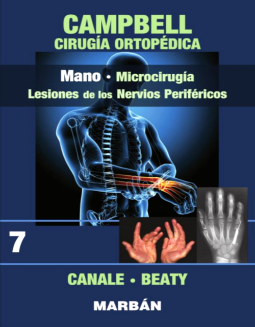 Cirugia Ortopedica Y Traumatologia T 7