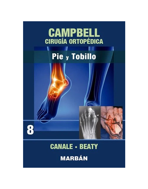 CAMPBELL Cirugía Ortopédica, Tomo 8: Pie y Tobillo
