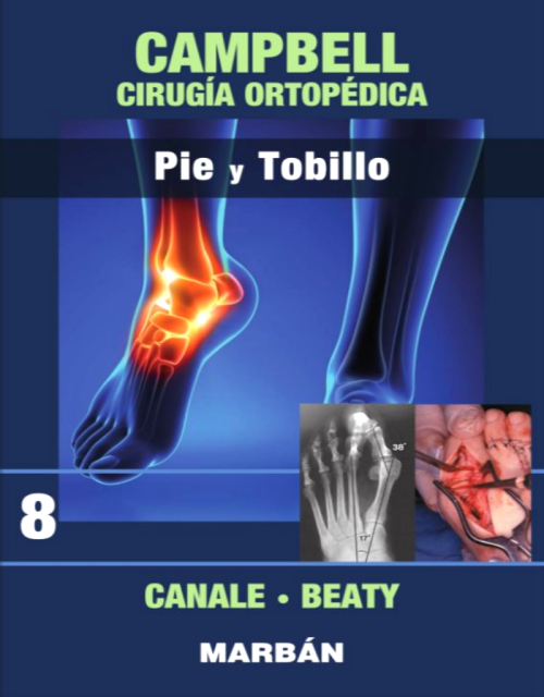CAMPBELL Cirugía Ortopédica, Tomo 8: Pie y Tobillo