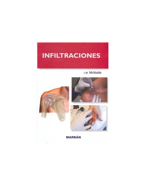Infiltraciones