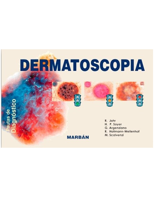 Dermatoscopia. Pautas de Diagnóstico
