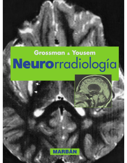 Neurorradiología