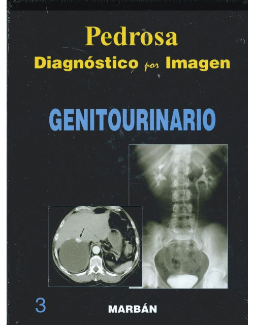 Diagnóstico Por Imagen, Vol. 3: Genitourinario