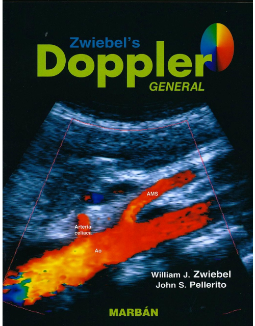 ZWIEBEL's Doppler General