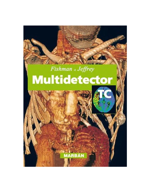 Multidetector TC