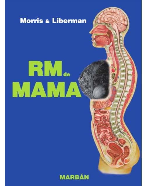 RM de Mama
