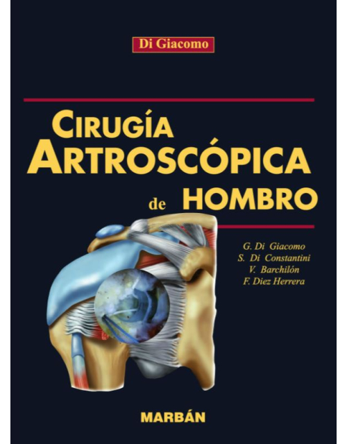 Artroscópica