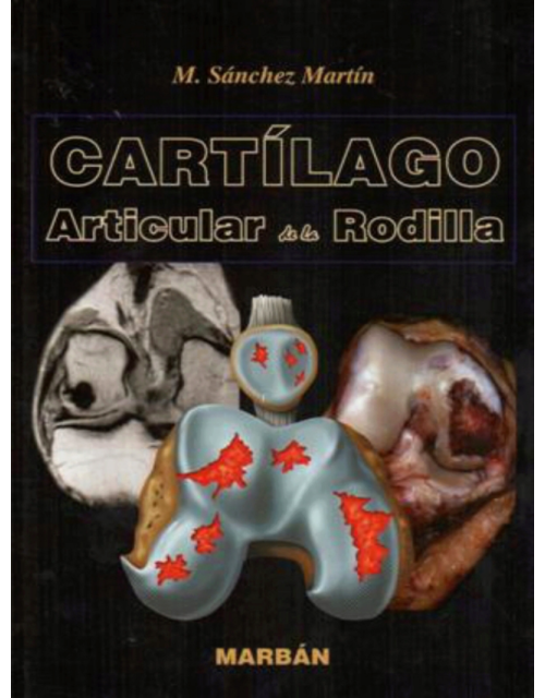 Cartilago Articular De La Rodilla
