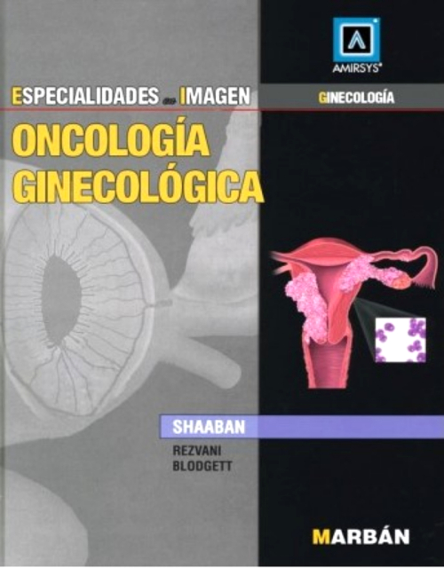 Esp En Img: Oncología Ginecológica