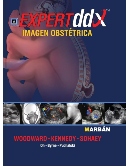 Expert Dd Imagen Obstetrica