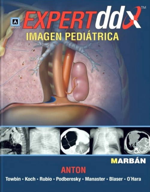 Expert Ddx Imagen Pediatrica
