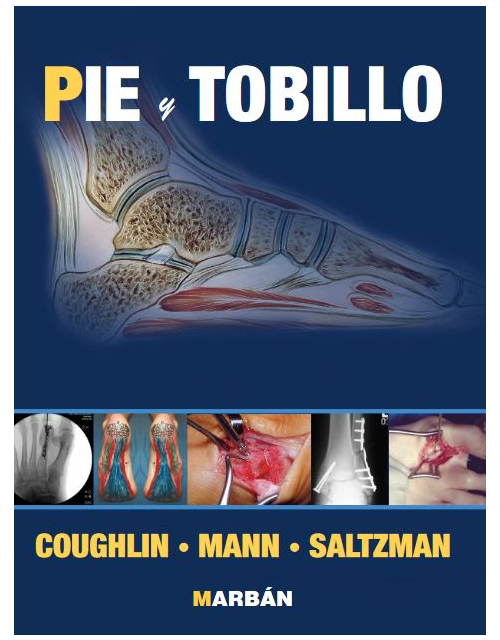 Cirugia de Pie y Tobillo