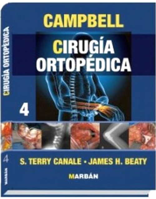 Cirugia Ortopedica Y Traumatologia Vol 4