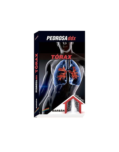 Pedrosa Ddx: Tórax
