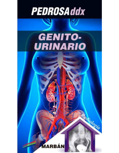 Pedrosa Ddx: Genitourinario.