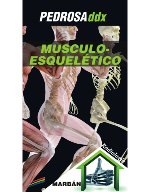 Pedrosa ddx: Musculoesquel&eacute;tico