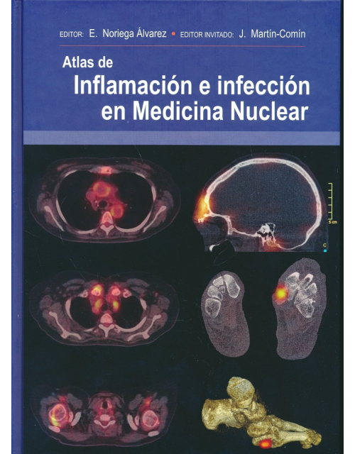 Atlas De Inflamación E Infección En Medicina Nuclear