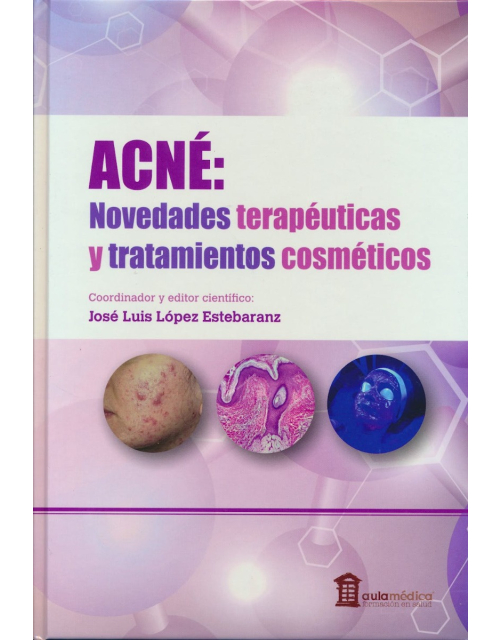 Acné. Novedades Terapéuticas y Tratamientos Cosméticos