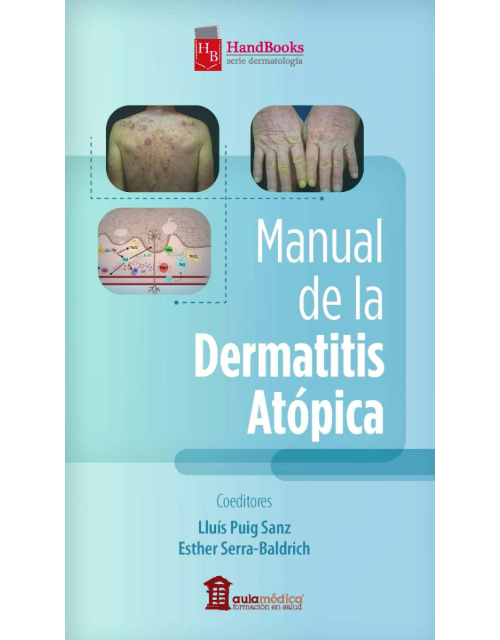 Manual de la Dermatitis Atópica