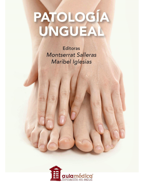 Patología Ungueal