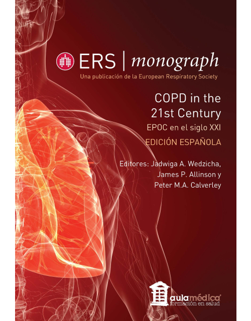 ERS | Monograph EPOC en el siglo XXI &ndash; COPD in the 21st Century EDICI&Oacute;N ESPA&Ntilde;OLA