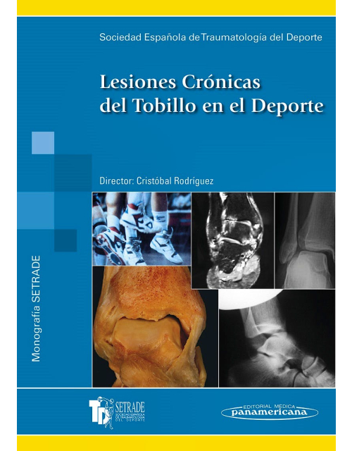 Lesiones Crónicas del Tobillo en el Deporte