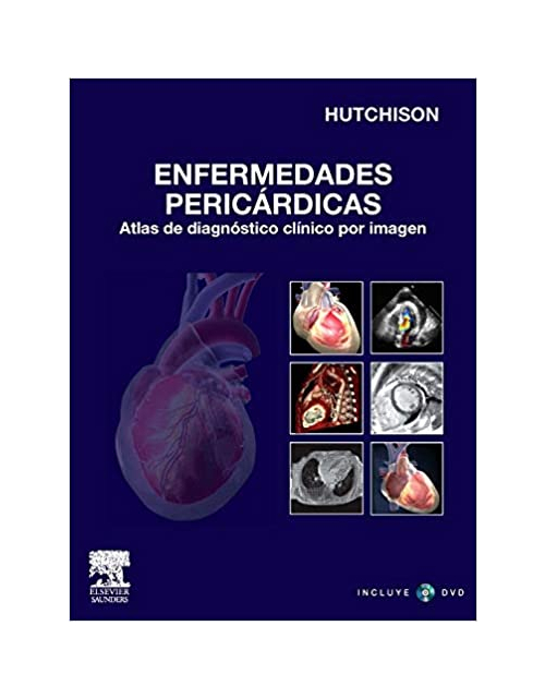 Enfermedades Pericárdicas + Dvd-Rom (Spanish Edition)