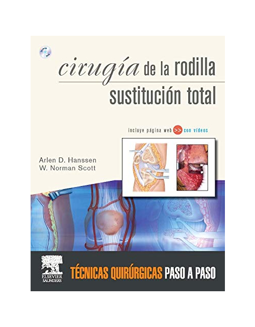Cirugía la rodilla. Sustitución total + DVD