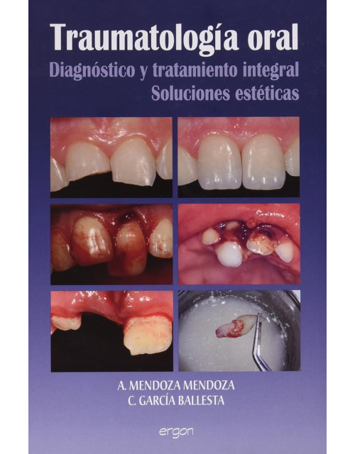 Traumatologia Oral